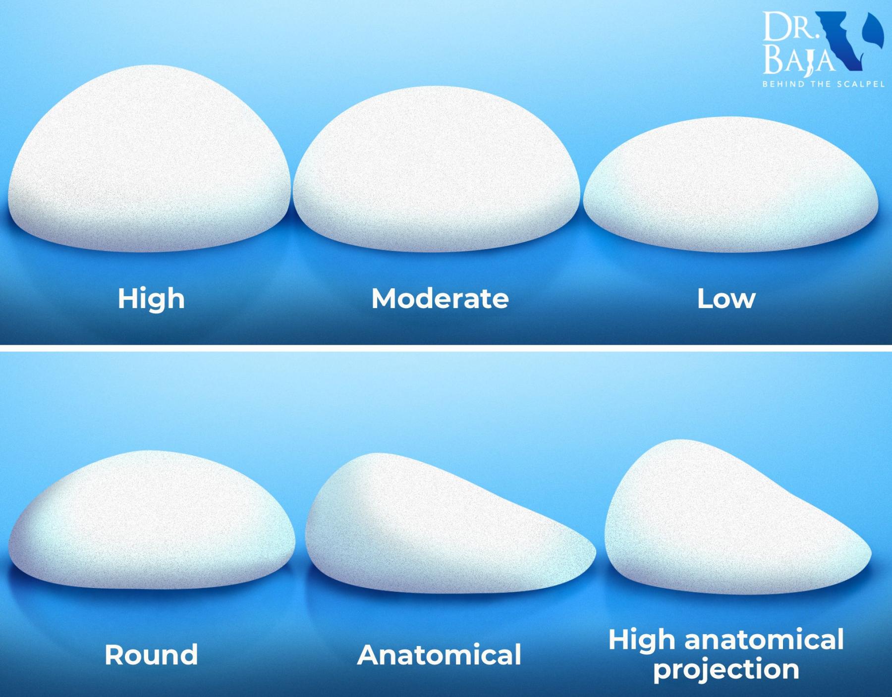 types of implants